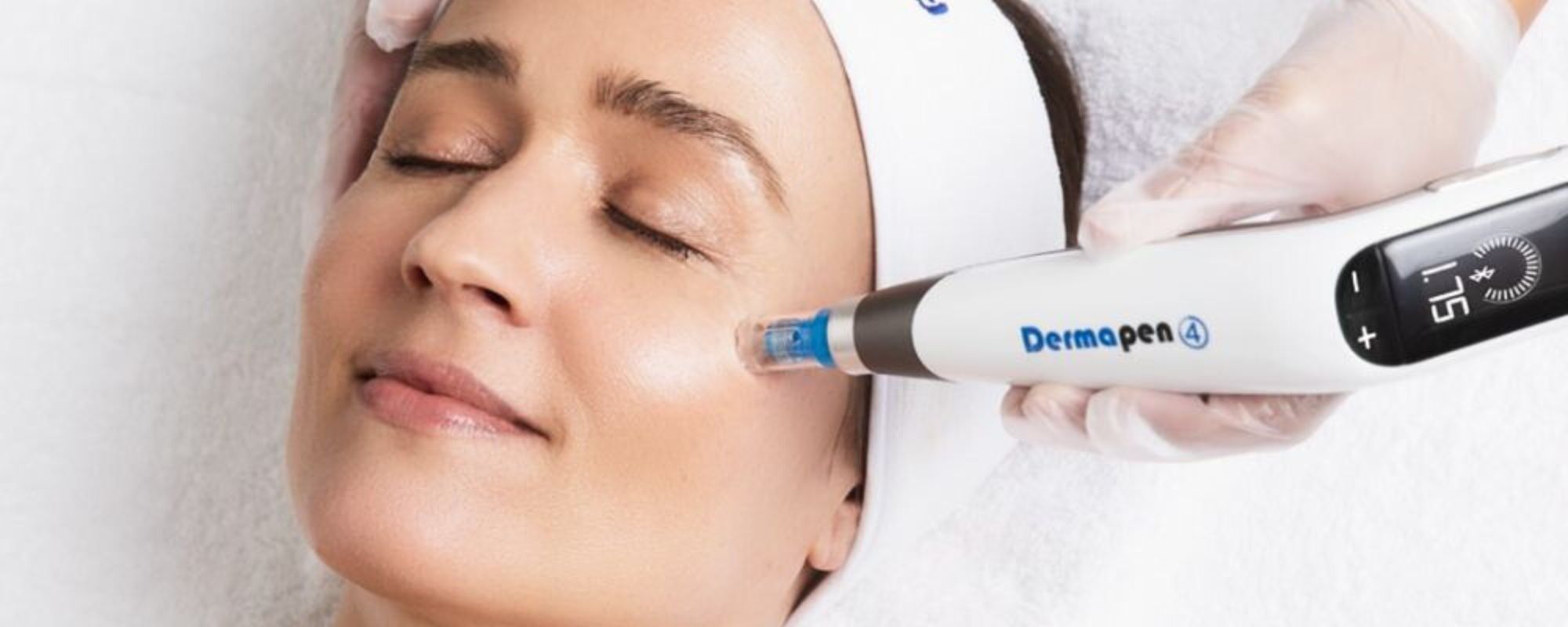 Dermapen Skin Needling